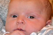 Photograph of a baby looking at the camera with a subtle white shade in the pupil of their right eye.