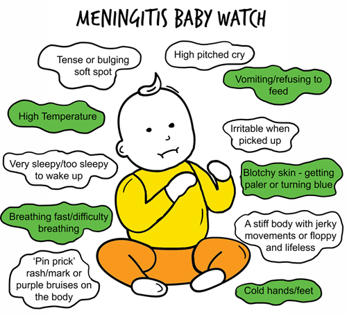 Meningitis in babies - Signs could also include blotchy skin, cold hands and feet, pin prick rash or purple bruises on body, high temperature, and breathing difficulties, along with other symptoms listed.